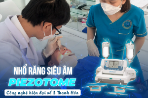 NHỔ RĂNG KHÔNG ĐAU – CÔNG NGHỆ SIÊU ÂM CHỈ CÓ TẠI NHA KHOA ÚC CHÂU