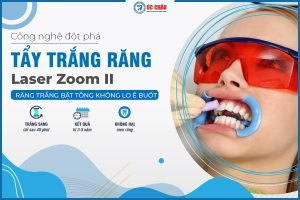 TẨY TRẮNG RĂNG – GIẢI PHÁP “CỨU CÁNH” HÀM RĂNG NHIỄM MÀU