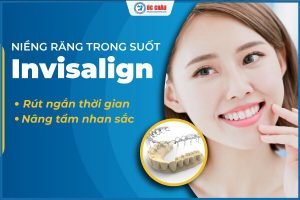 NIỀNG RĂNG KHAY TRONG – THẨM MỸ TUYỆT ĐỐI, HIỆU QUẢ TRỌN ĐỜI