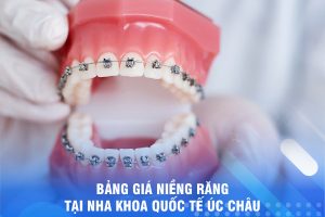  BẢNG GIÁ NIỀNG RĂNG TẠI NHA KHOA QUỐC TẾ ÚC CHÂU