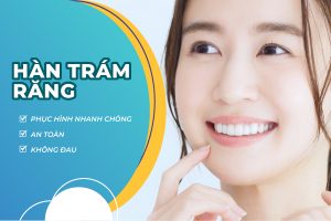 Hàn trám răng – Phục hồi răng sâu, gãy vỡ, thưa đẹp như răng thật