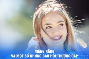  NIỀNG RĂNG THẨM MỸ VÀ MỘT SỐ NHỮNG CÂU HỎI THƯỜNG GẶP