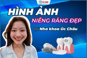Hình ảnh niềng răng đẹp tại Nha khoa Quốc tế Úc Châu Hình ảnh niềng răng đẹp tại Nha khoa Quốc tế Úc Châu