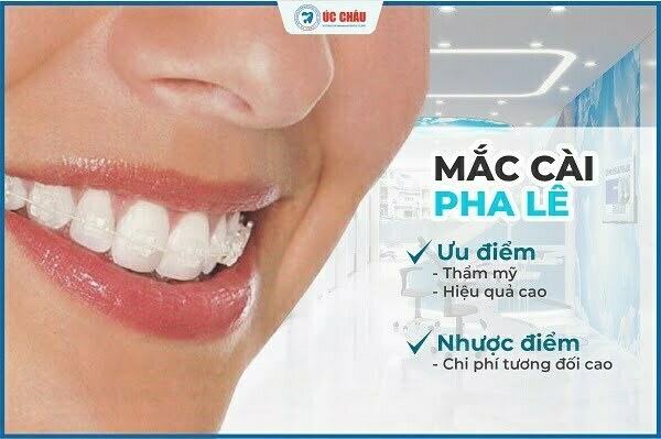 niềng răng là gì niềng răng là gì