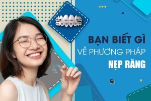 NẸP RĂNG: NẸP RĂNG LÀ GÌ? CHI PHÍ HẾT BAO NHIÊU? NẸP RĂNG: NẸP RĂNG LÀ GÌ? CHI PHÍ HẾT BAO NHIÊU?