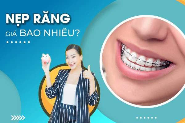nẹp răng nẹp răng