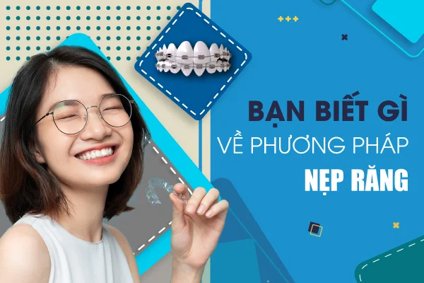nẹp răng nẹp răng