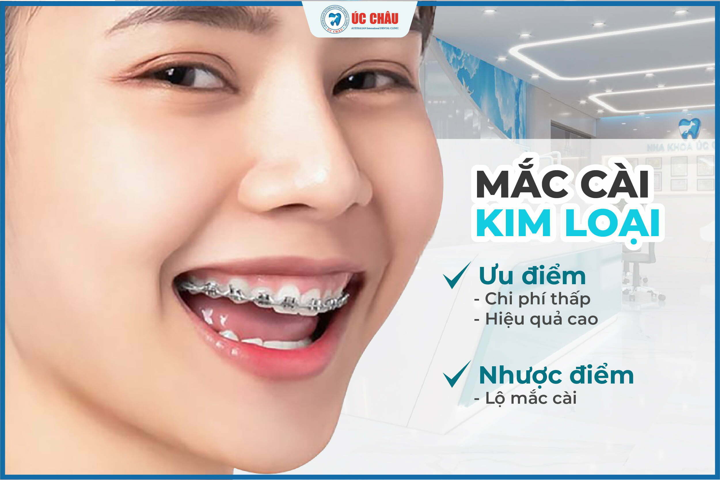 niềng răng là gì niềng răng là gì