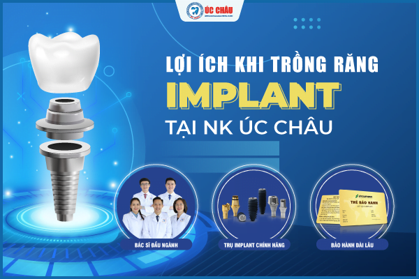 quy trình cấy ghép răng implant quy trình cấy ghép răng implant