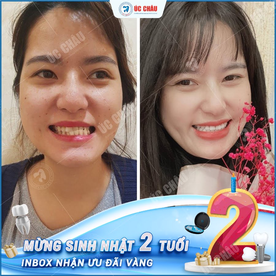 sinh-nhat-nha-khoa