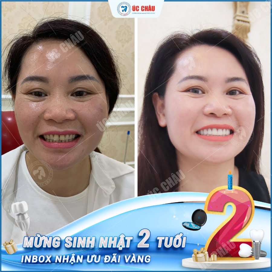 sinh-nhat-nha-khoa
